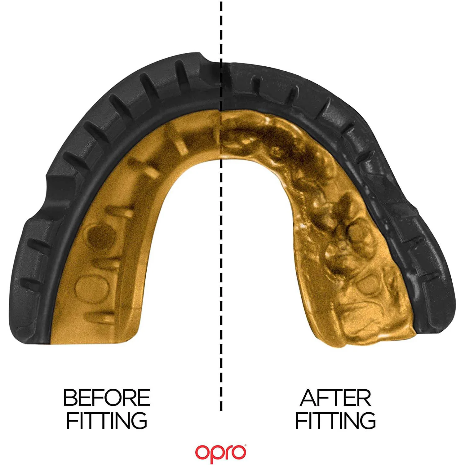 Opro Self-Fit Mouthguard For Braces - Gold Level - Image 4