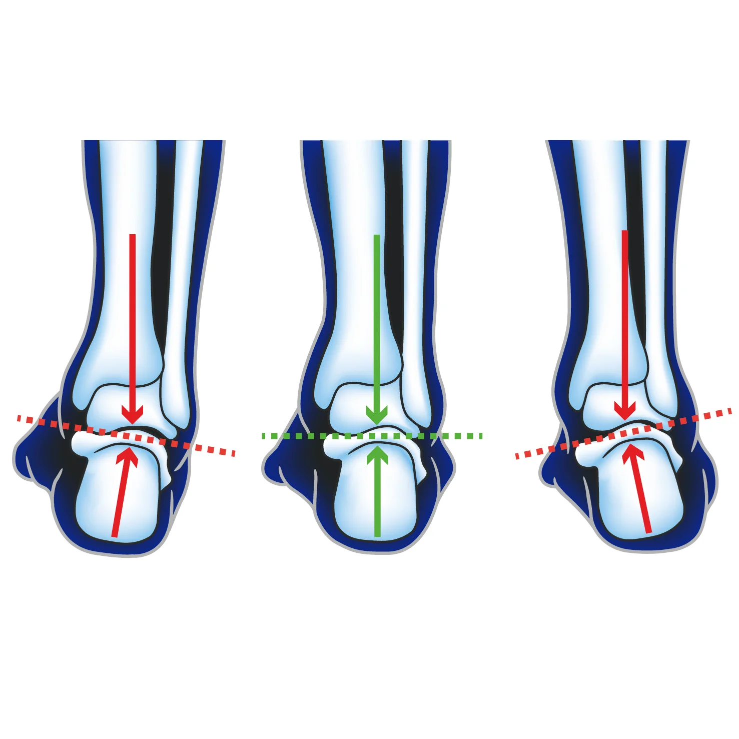 Ultimate Performance Advanced F3D Neutral Insole - Image 6